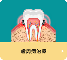 歯周病治療