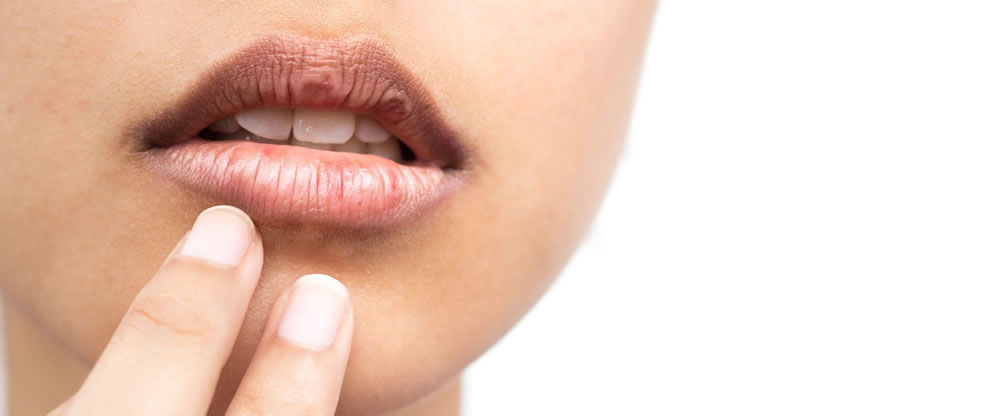 お口の中が乾燥するドライマウスの原因や対処法