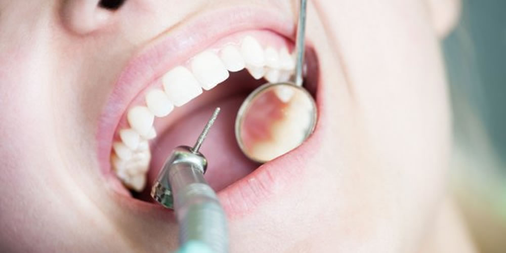 つめ物（かぶせ物）の治療後に歯が痛みを感じる原因