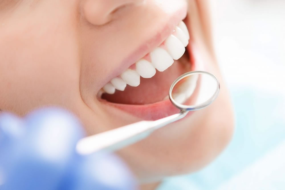 歯科検診・歯のクリーニング