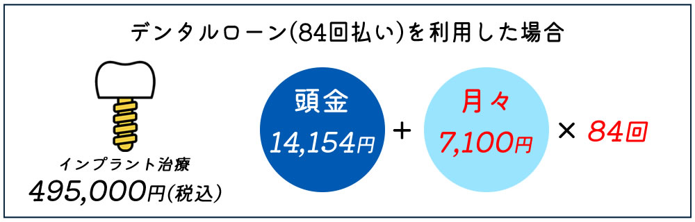 デンタルローンの分割例