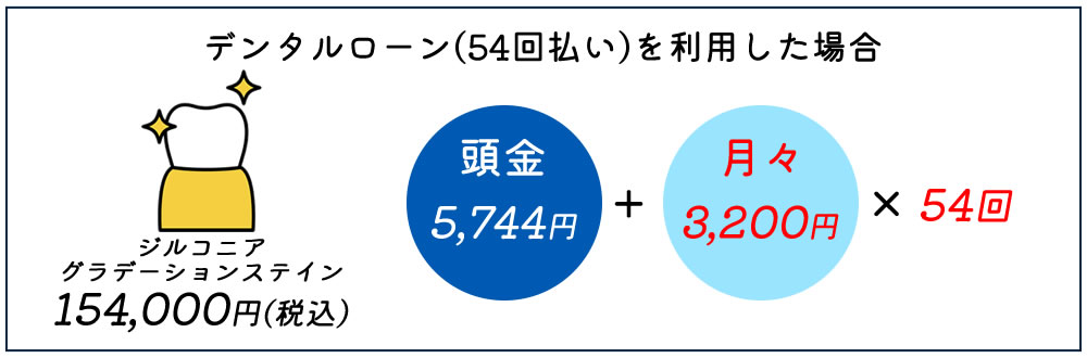 デンタルローンの分割例